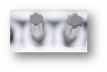 Jeu d'embouts OGV grip 1/2